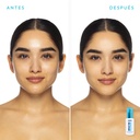 galeria-before-after-holdtheclock-1400x1400px-b-a-modelo2